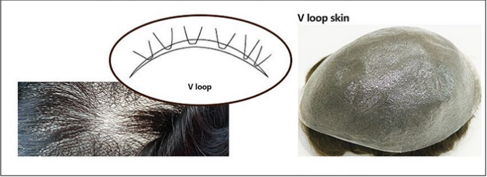 vloop for hair system1.png